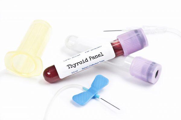 Naturopaths and many of the more progressive physicians and endocrinologists are using a combination of lab tests and looking at symptoms (Photog/Shutterstock)