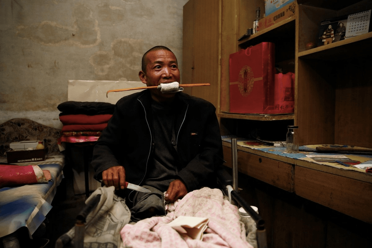 Desperate DIY Health Methods Chinese Used to Avoid Staggering Medical Bills