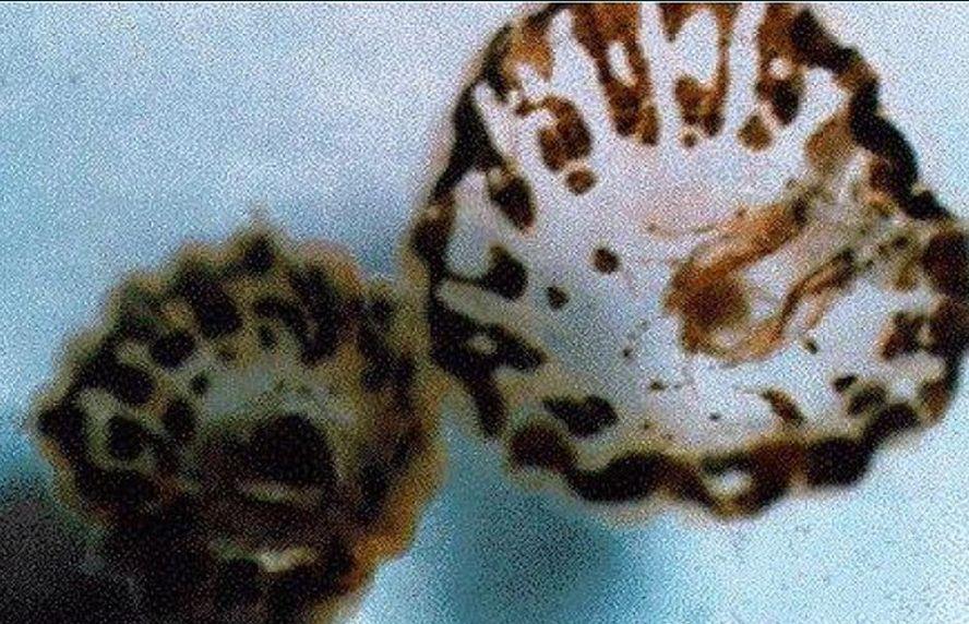 ‘Sea Lice’ Outbreaks Reported in Florida, Texas