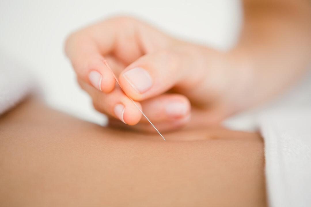 Acupuncture Beats Drug for Gastritis Relief