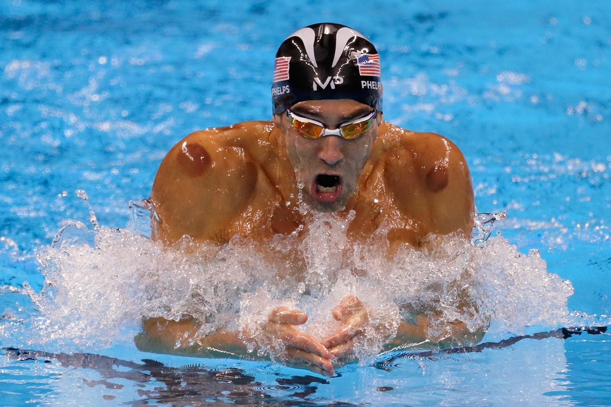 A Short History of Cupping