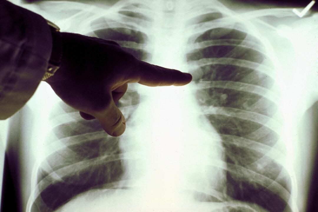 Your Lung Function Is an Important Predictor of Health and Longevity