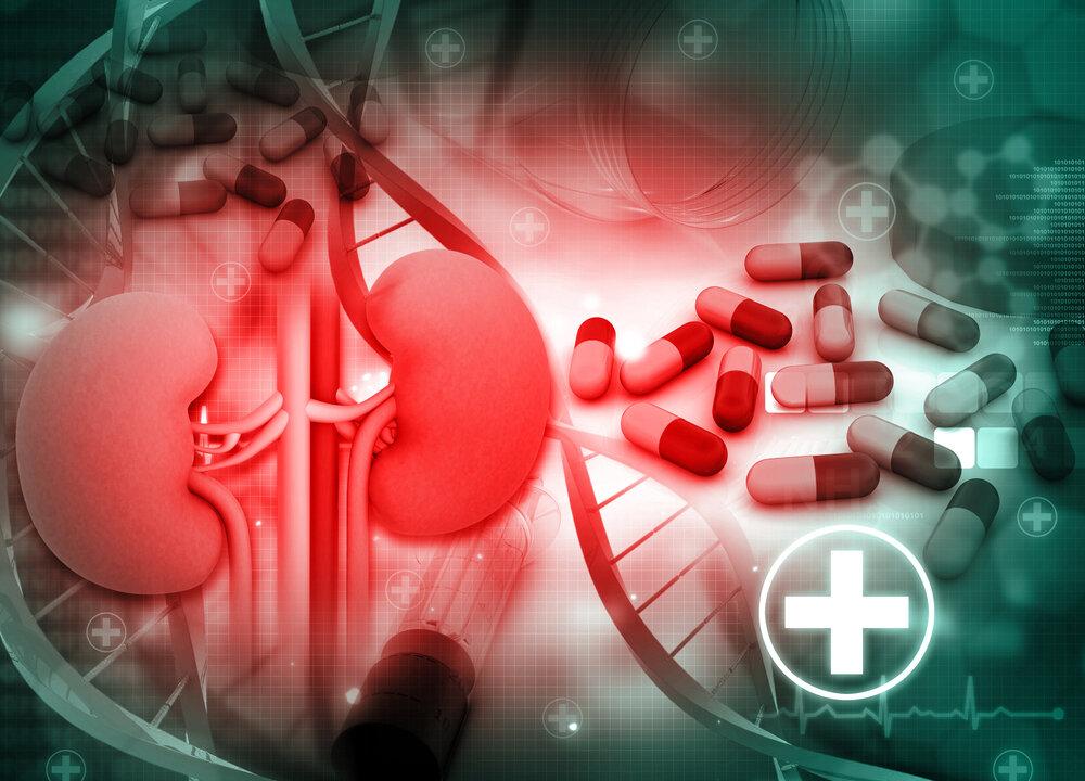 Summer Is High-Risk Time for Kidney Stones