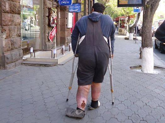 The Story of a Beggar