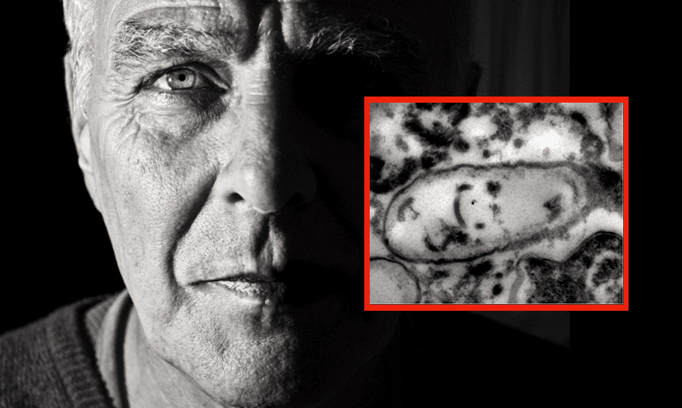 Eye-Eating Parasite from Water Park Leaves Man Impaired, Lawsuit Says