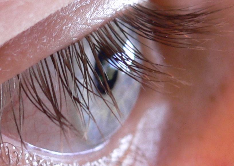 Woman Complained of ‘Itchy Eyes,' Then Doctors Make Unusual Find in Her Eyelashes