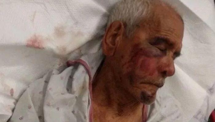 Woman, 30, Accused of Attacking 92-Year-Old Man Is Charged With Attempted Murder