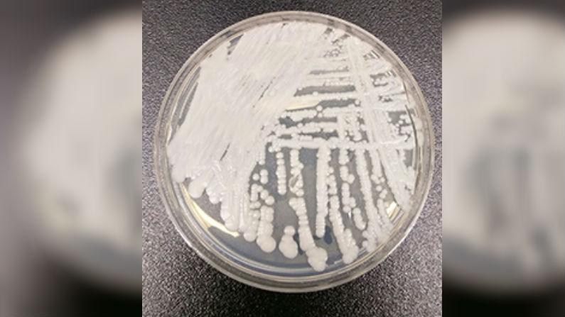 Oregon Hospital System Reports Outbreak of Rare Fungal Superbug