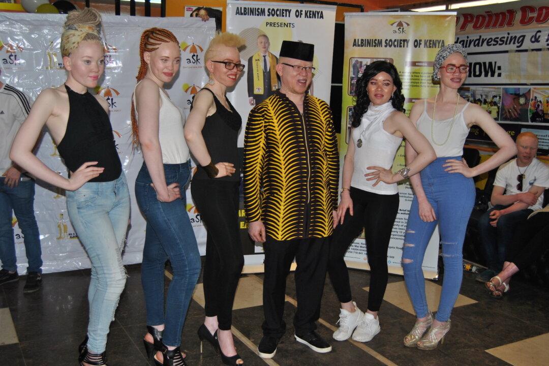 Beauty Beyond the Skin: Contestants in Africa Gear up for Albino Pageant