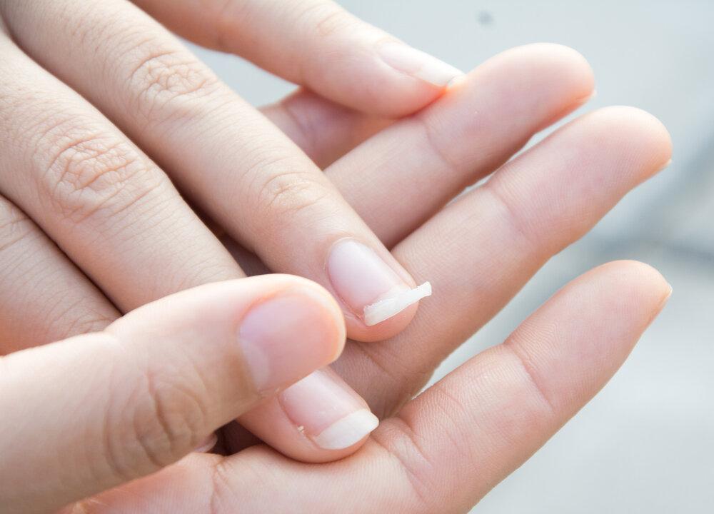 Woman’s Warning Goes Viral After Finding out Curved Fingernails Are a Sign of Lung Cancer