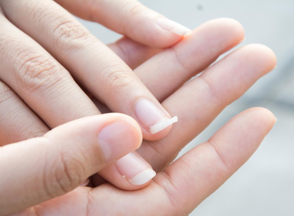 What Fingernails Say About Your Health and How to Maintain Them