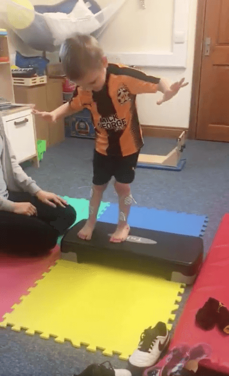 Four year old Ronnie is undergoing physiotherapy after an operation and recently walked his first steps without splints. (Steve Leys/Twitter)