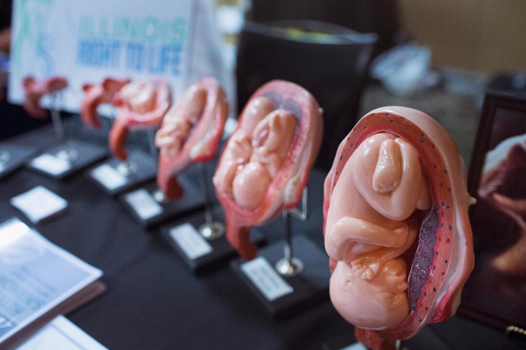 Late-Term Abortion: A Complex Moral Debate in America