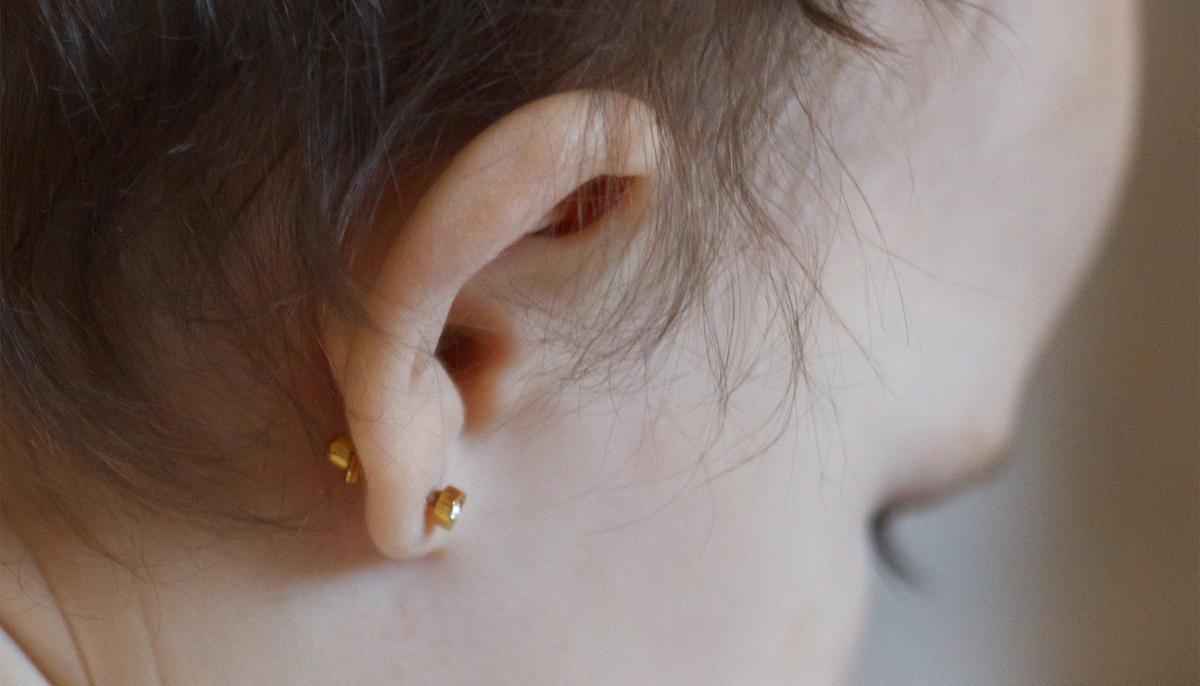 Cochlear Implant Helps Baby with Rare Hearing Disorder Hear Parents for the First Time