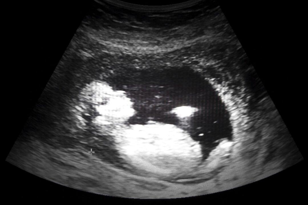 Pro-Choice Student Says Babies Born After Botched Abortions Aren’t Babies