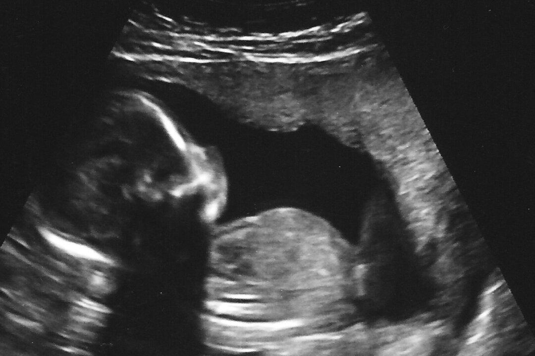 Mississippi Governor Signs Bill That Bans Abortions After Unborn Baby’s Heartbeat Detected