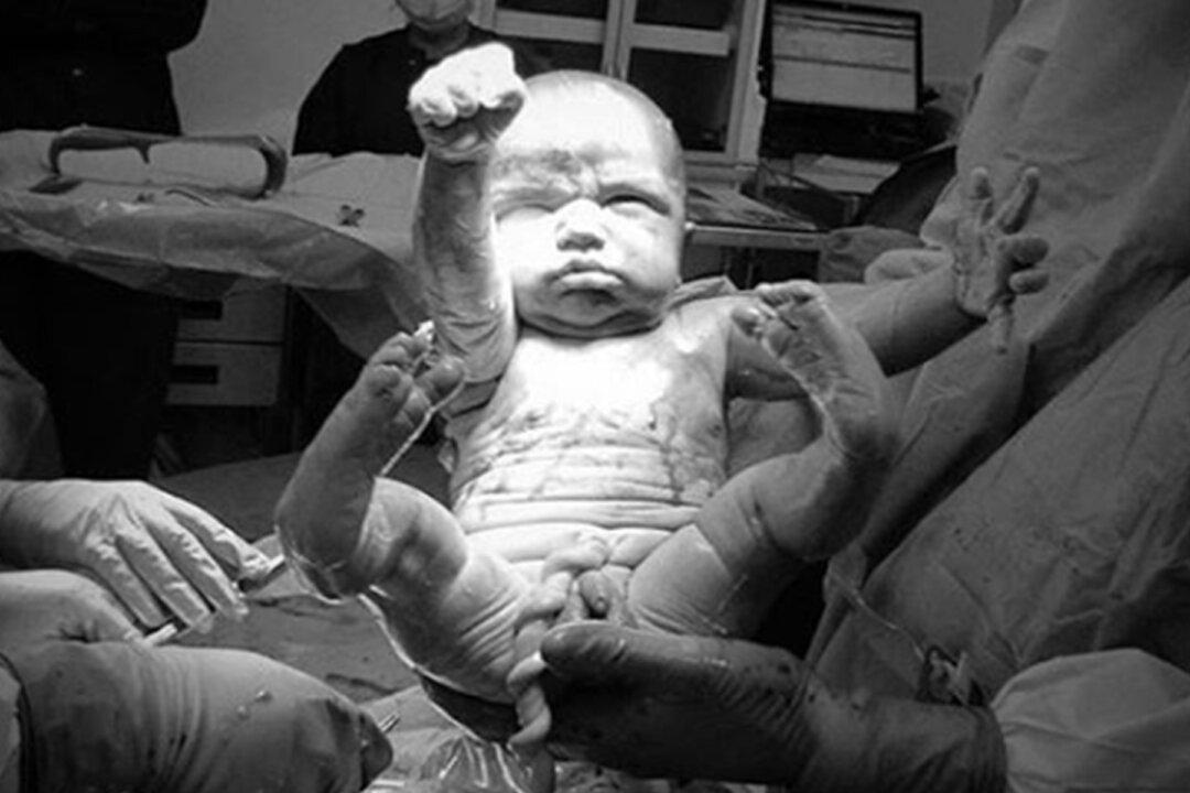 Father Captures Baby Striking Iconic Superman Pose Just Seconds After Being Born