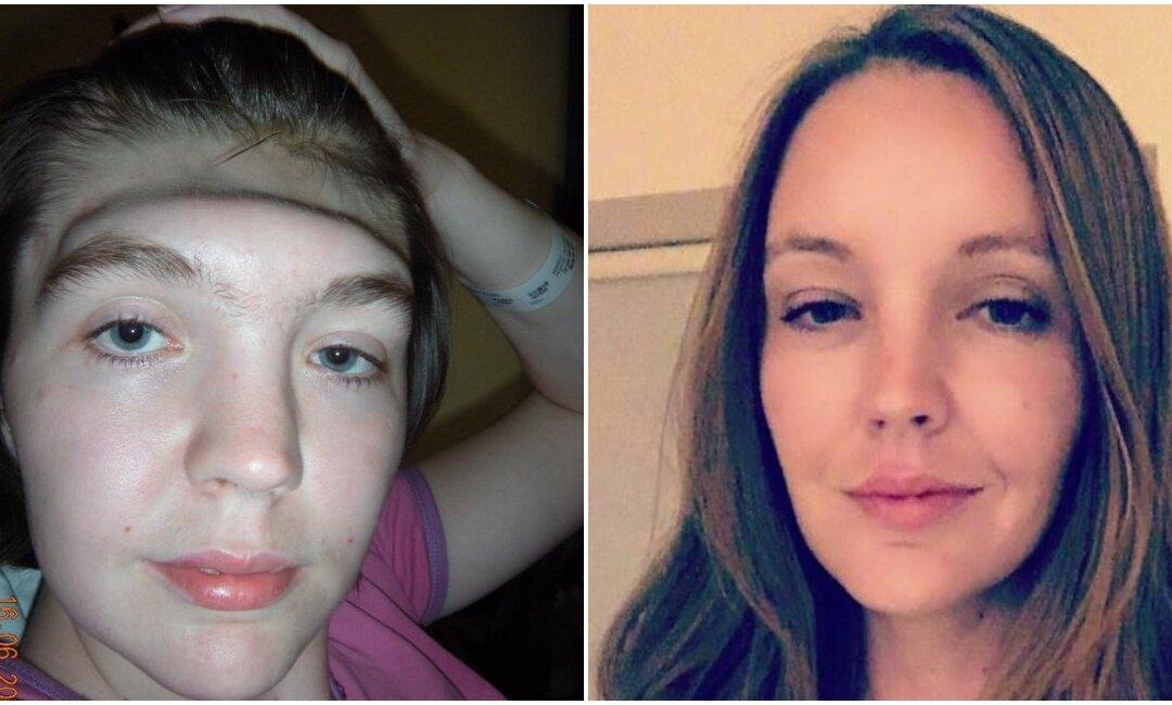 Celebrities With Feet on Dash Spark Warning From Woman Who Lost Forehead in Crash