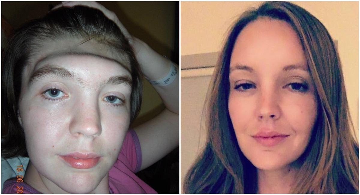 Celebrities With Feet on Dash Spark Warning From Woman Who Lost Forehead in Crash