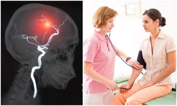 80% of strokes are preventable by maintaining a healthy lifestyle and taking more care of your health. (Shutterstock)
