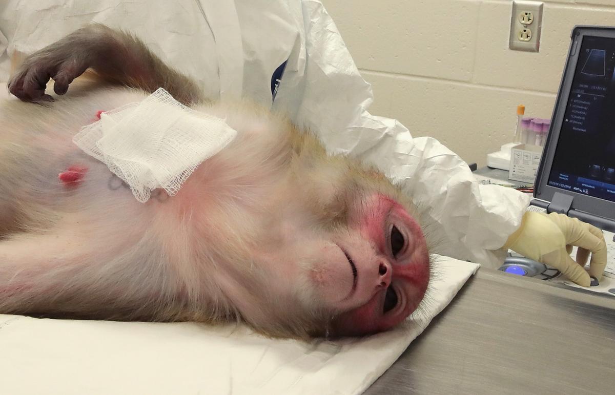 Chinese Scientists Implant Human Brain Genes into Monkeys