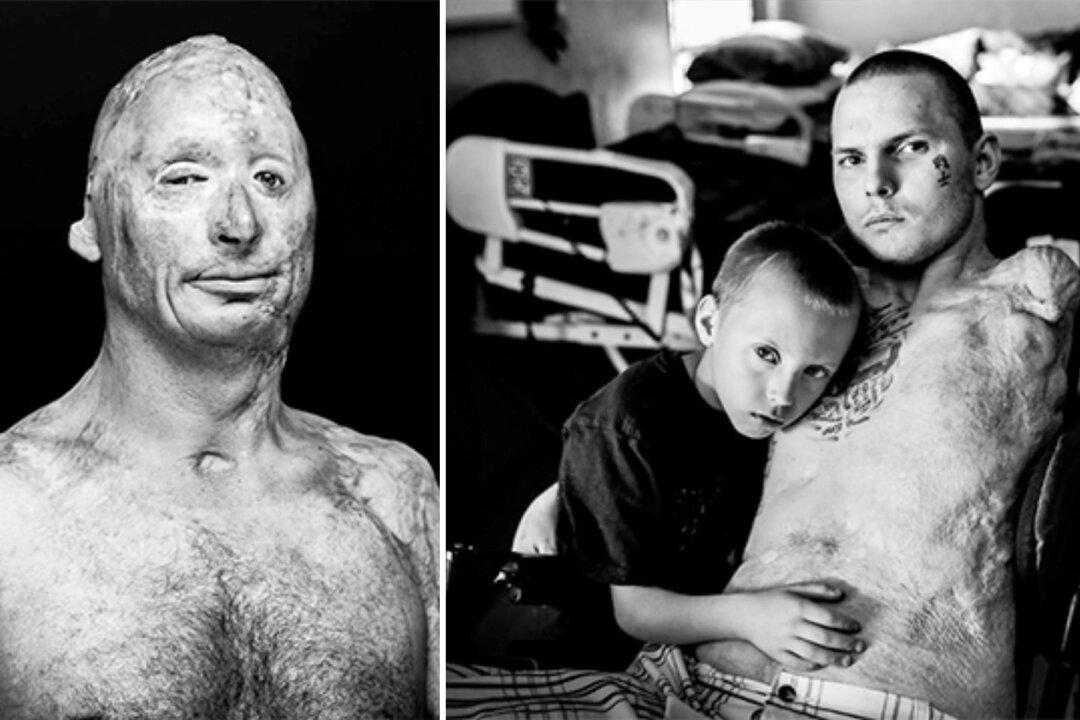 10 Graphic Photos of Heroic Veterans After War in Iraq and Afghanistan: No Words Needed
