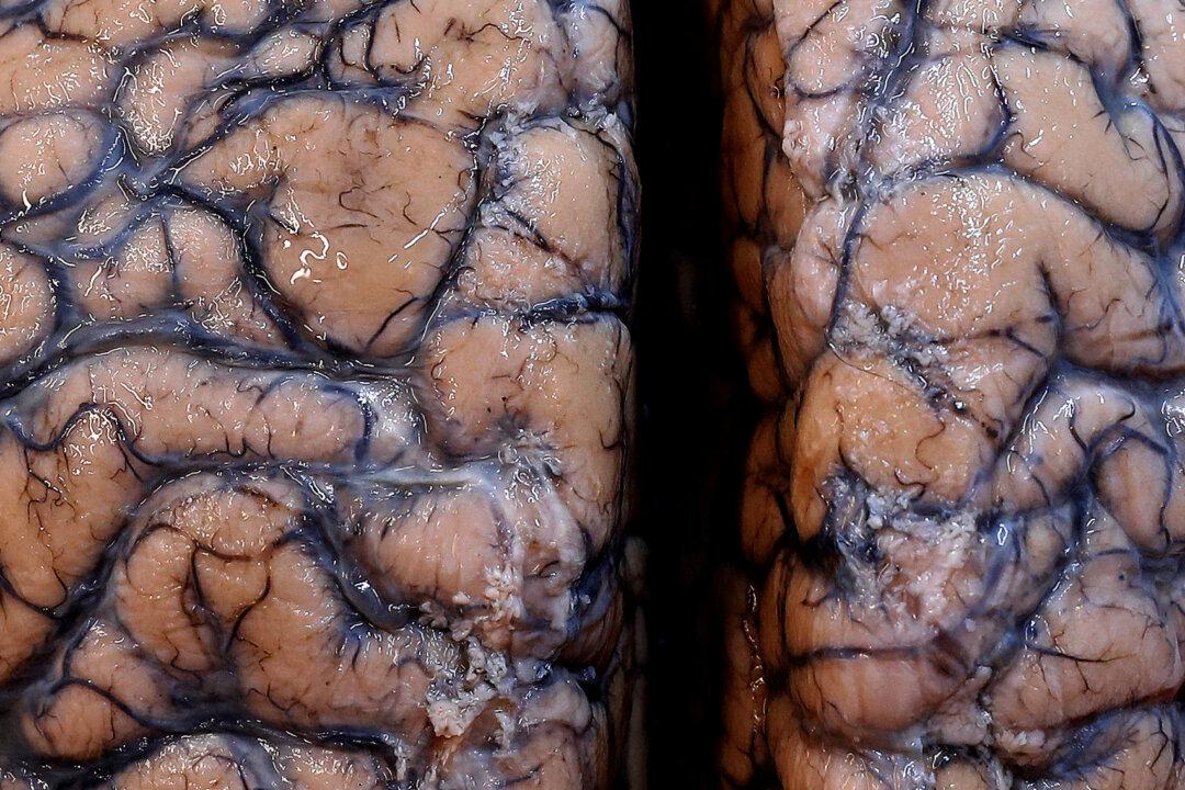 Rare Brain-Eating Amoeba Infection Confirmed in a Man in Florida