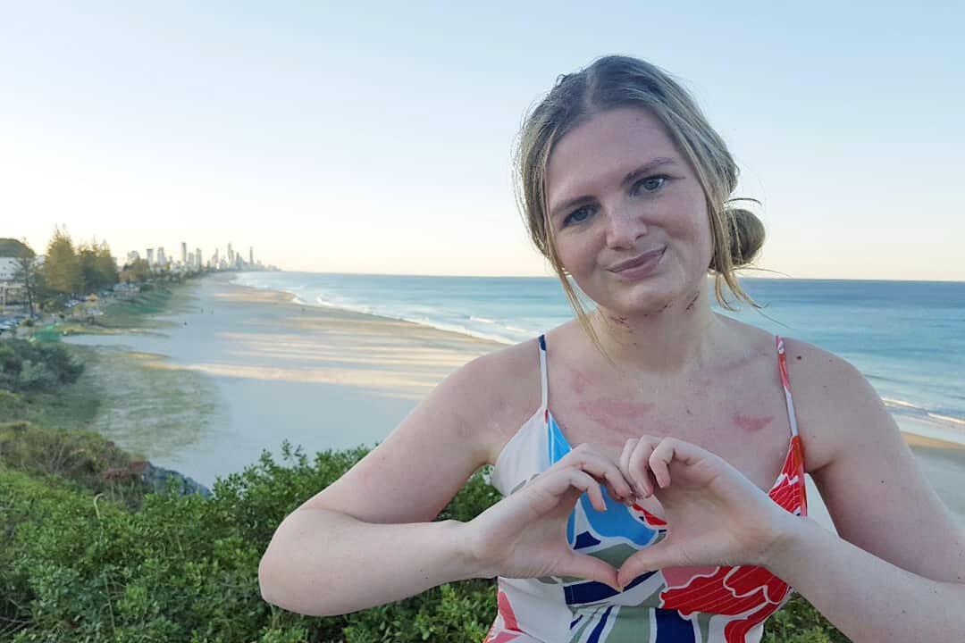 Woman Almost Loses Her Tongue From Severe Tooth Infection