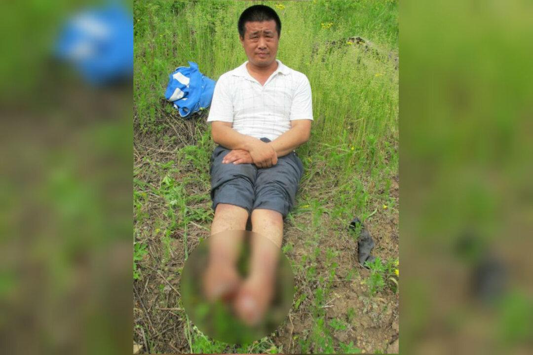 Man Who Lost Both Feet From Police-Inflicted Torture Dies