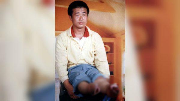 Wang after his feet were amputated. (Minghui.org)