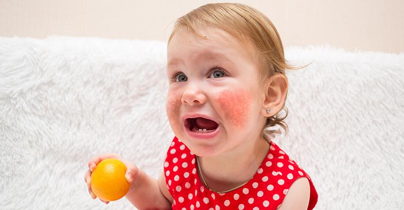 No Enigma: Vaccines and the Food Allergy Epidemic