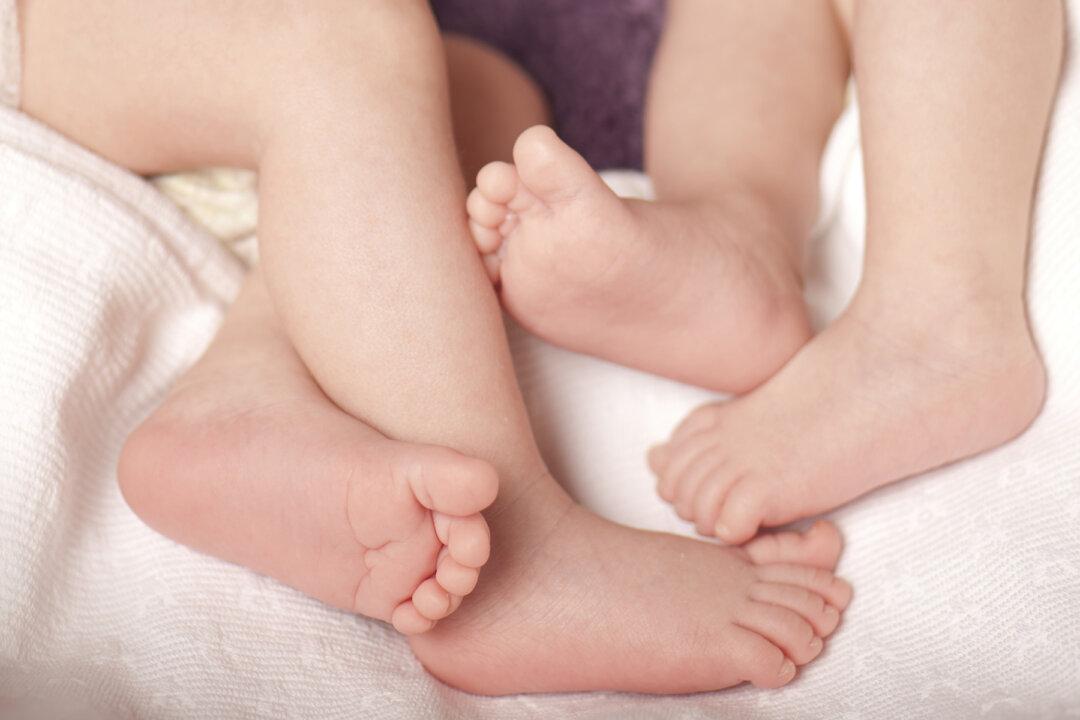 Conjoined Twins Who Survived 11-Hour Separation Surgery Are Now Thriving 2-Year-Olds