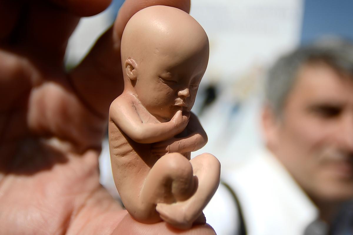 Abortion Advocates Have Faced the Realities of Abortion—and They’ve Looked Away