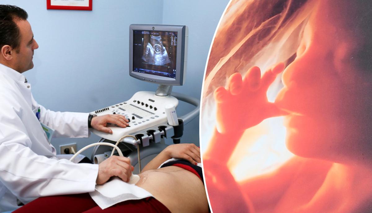 Grieving Mom Claims Abortion Is Murder With Photos of 14-Week-Old Miscarried Baby