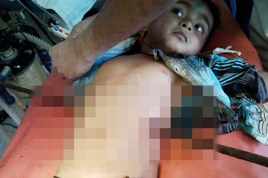 3-Year-Old Miraculously Survives After Falling on Iron Rod That Skewered His Chest