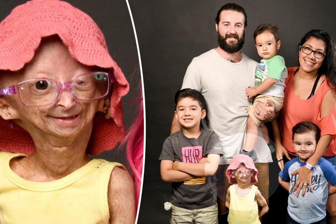 12-Year-Old Girl With Rare ‘Aging Disease’ Becomes Internet Sensation Despite Negativity