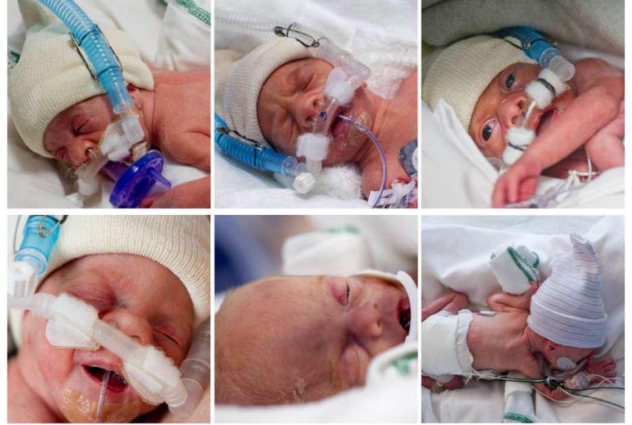Texas Mother Describes ‘Controlled Chaos’ of Raising Sextuplets