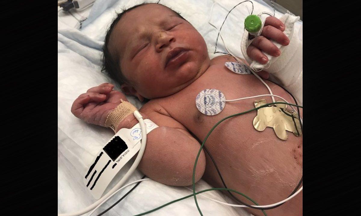 This photo released by the Forsyth County Sheriff's Office shows a newborn baby girl found alive in a plastic bag in a wooded area in Cumming, Ga., by Forsyth County deputies on June 6, 2019. (Forsyth County Sheriff's Office via AP)