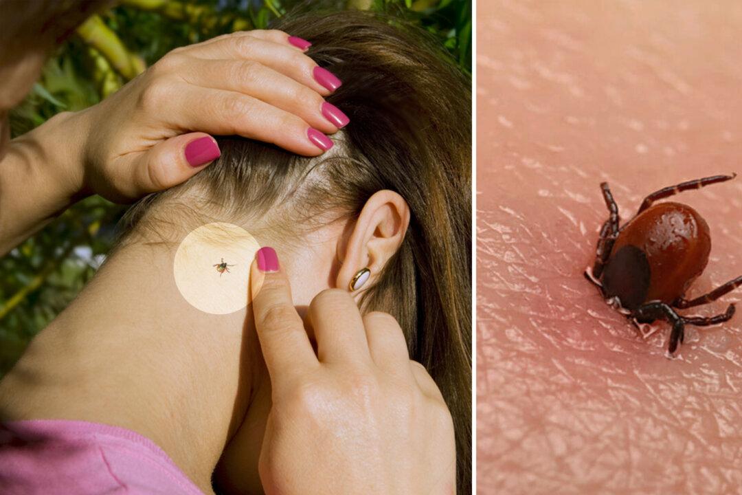 Want to Avoid Tick Bites This Summer? Here Are 5 Cheapest Tips You Should Know