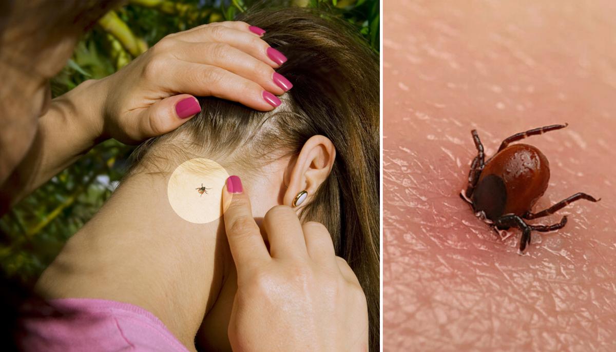 Want to Avoid Tick Bites This Summer? Here Are 5 Cheapest Tips You Should Know