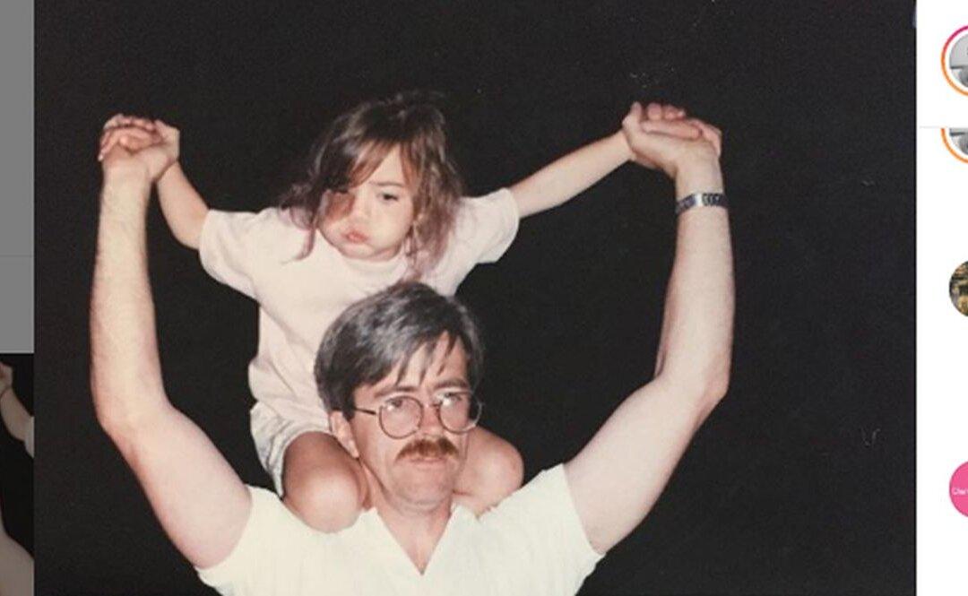 Dancer Accepts Face Birthmark, Refuses to Get Cosmetic Surgery