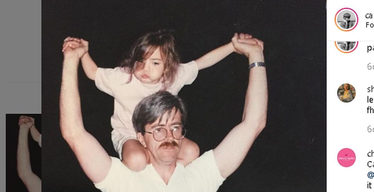 Dancer Accepts Face Birthmark, Refuses to Get Cosmetic Surgery