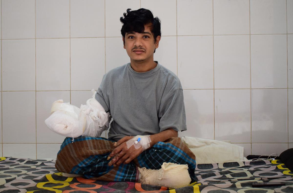 ‘Tree Man’ Asks Surgeons to Amputate His Hands Due to Pain of Bark-Like Growths