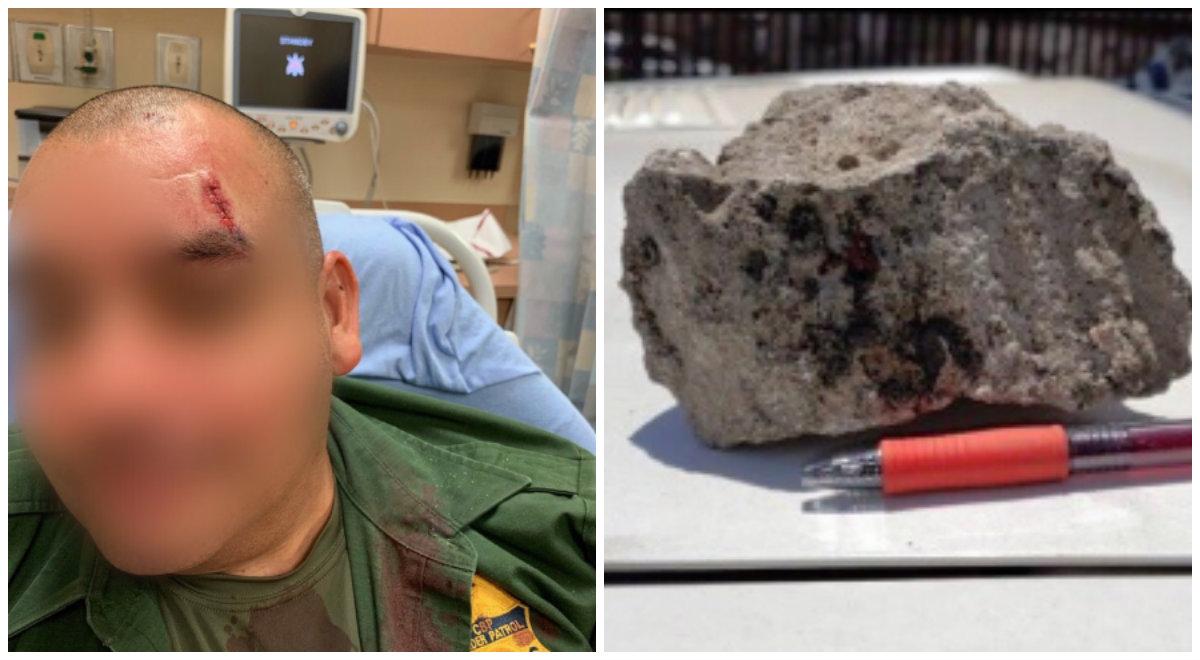 Border Patrol Injured After Rock Was Thrown at His Patrol Car in California