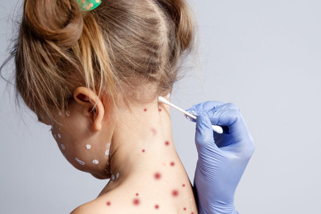 6-Year-Old’s Plan to Skip School Backfires When Her ‘Chicken Pox’ Won’t Come Off