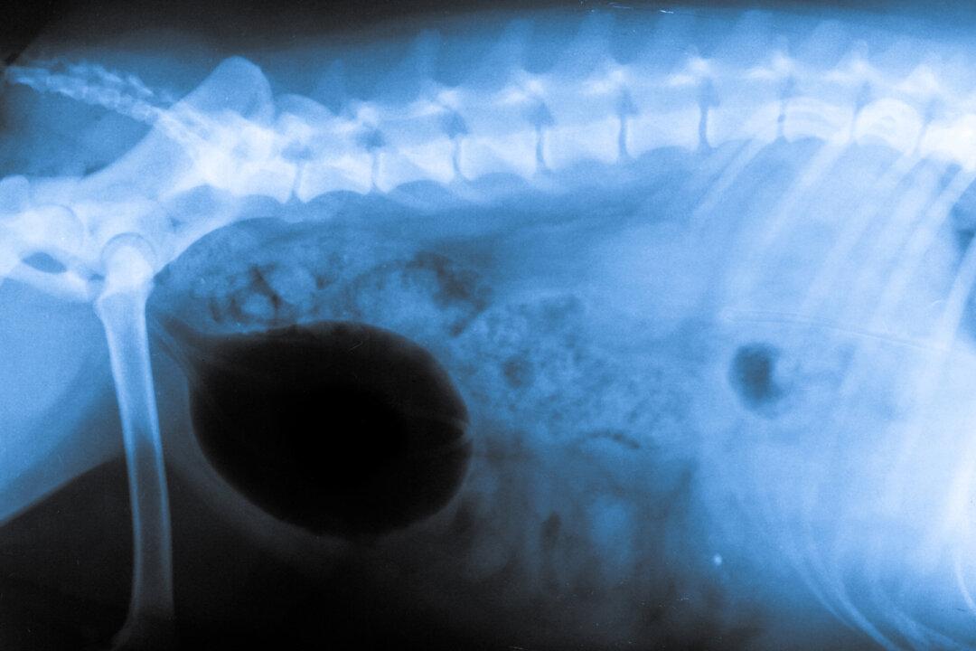 Hound Born With Half a Spine and No Neck Is ‘The Happiest Dog’ After Getting Adopted