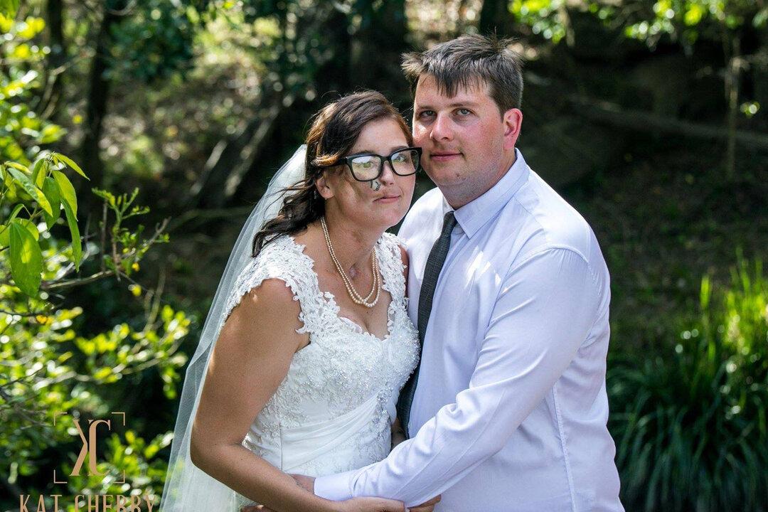 23-Year-Old Dies Months After Wedding to Face-Deforming Cancer