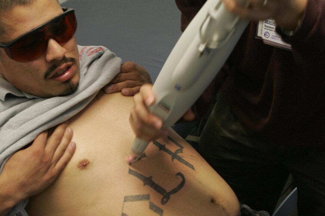 Tattoo Removal Can Give Inmates a New Lease on Life