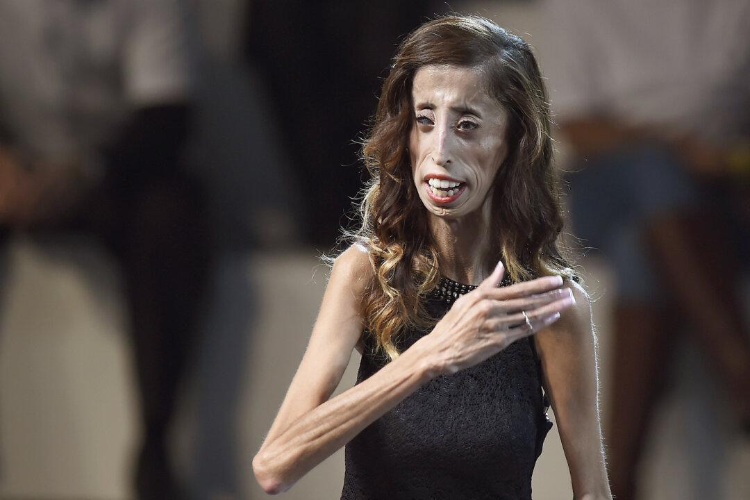 Girl Silenced Haters With Moving Message After Being Labeled ‘World’s Ugliest Woman’