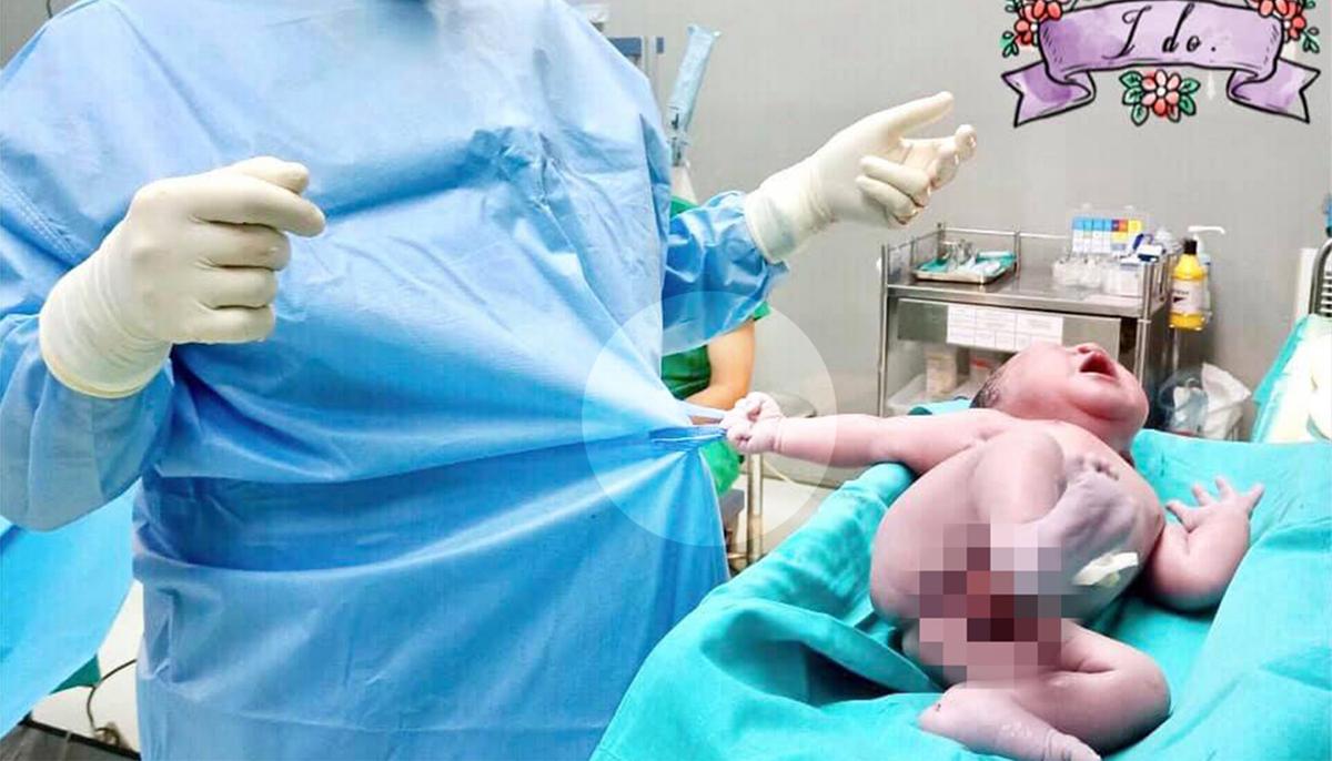 ‘Baby Strong’: Newborn Grabs Doctor’s Scrubs Right After Birth and Just Won’t Let Go